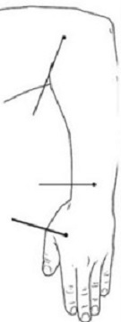 Points on hand for headaches